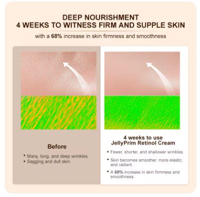 Wrinkle Retinol Anti-Aging Face Cream